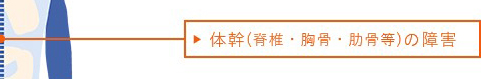 体幹（脊椎・胸骨・肋骨等）の障害